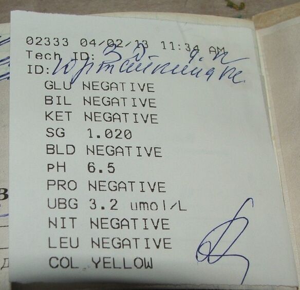 Os meus resultados de análise de orina antes de femixal